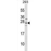 Signal-Regulatory Protein Delta (SIRPD) Antibody