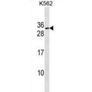 Protein SSX3 (SSX3) Antibody
