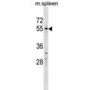 WB analysis of mouse spleen tissue.