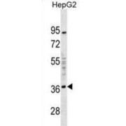 Tumor Necrosis Factor Receptor Superfamily Member 27 (EDA2R) Antibody