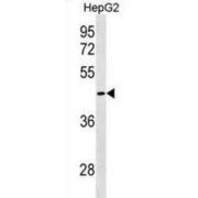 PDZ Domain-Containing Protein GIPC3 (GIPC3) Antibody