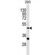 abx030272