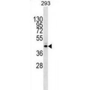 Methyltransferase-Like Protein 2B (METTL2B) Antibody