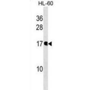 Diphosphoinositol Polyphosphate Phosphohydrolase 3-Alpha (NUDT10) Antibody