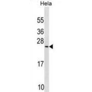 PRELI Domain-Containing Protein 1, Mitochondrial (PRELID1) Antibody