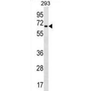 Zinc Finger Protein 426 (ZNF426) Antibody