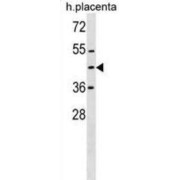 Zinc Finger Protein 558 (ZNF558) Antibody