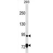 Exonuclease Mut-7 Homolog (EXD3) Antibody