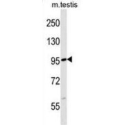 F-Box/LRR-Repeat Protein 19 (FBXL19) Antibody