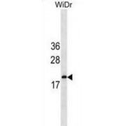 Interferon Alpha 5 (IFNA5) Antibody
