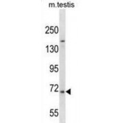WB analysis of mouse testis tissue lysates.