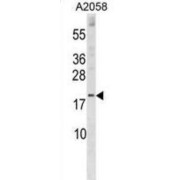 Sorting Nexin 3 (SNX3) Antibody