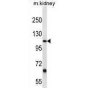 Prostaglandin F2 Receptor Negative Regulator (PTGFRN) Antibody