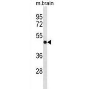 Protein Phosphatase 4 Regulatory Subunit 2 (PPP4R2) Antibody
