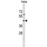 RNA Binding Motif Protein 41 (RBM41) Antibody