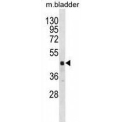 RNA Binding Motif Protein 41 (RBM41) Antibody