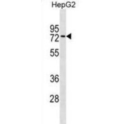 Zinc Finger Protein 614 (ZNF614) Antibody