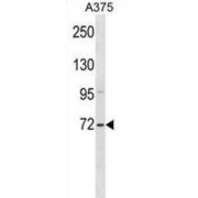 Zinc Finger SWIM Domain-Containing Protein 2 (ZSWIM2) Antibody