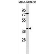 Abhydrolase Domain Containing 1 (ABHD1) Antibody