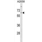 Kelch-Like Protein 14 (KLHL14) Antibody