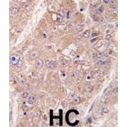 UV Radiation Resistance-Associated Gene Protein (UVRAG) Antibody