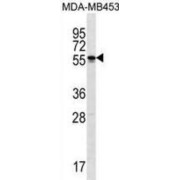 Spermatogenesis- And Oogenesis-Specific Basic Helix-Loop-Helix-Containing Protein 2 (SOHLH2) Antibody