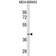 Cysteine-S-Conjugate Beta-Lyase (CCBL1) Antibody