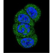 Phosphatidylinositol 3-Kinase Catalytic Subunit Type 3 (PI3KC3) Antibody