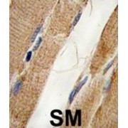 Phosphatidylinositol 3-Kinase Catalytic Subunit Type 3 (PI3KC3) Antibody