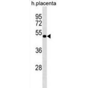 LIM/Homeobox Protein Lhx8 (LHX8) Antibody