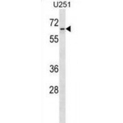 Zinc Finger Protein 768 (ZNF768) Antibody