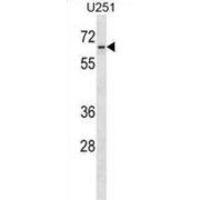 Zinc Finger Protein 768 (ZNF768) Antibody