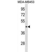 ALG8, Alpha-1,3-Glucosyltransferase (ALG8) Antibody