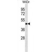ER Lipid Raft Associated 2 (ERLIN2) Antibody