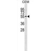 Erythroblast Membrane Associated Protein (Scianna Blood Group) (ERMAP) Antibody