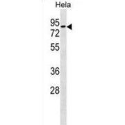 Mitochondrial Rho GTPase 1 (RHOT1) Antibody