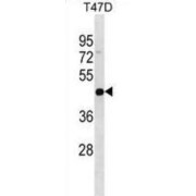 Interleukin 22 Receptor Alpha 2 (IL22RA2) Antibody