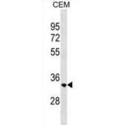 Ras-Related Protein Rab-40C (RAB40C) Antibody