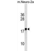 Leucine Zipper Protein Down-Regulated In Cancer Cells-Like (LDOC1L) Antibody