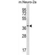 THO Complex 6 (THOC6) Antibody