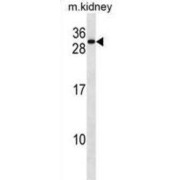 Receptor Accessory Protein 5 (REEP5) Antibody