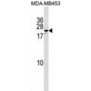 Zinc Finger Protein 580 (ZNF580) Antibody