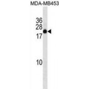 Zinc Finger Protein 747 (ZNF747) Antibody