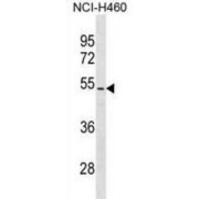 Phosphatidylinositol-3,4,5-Trisphosphate 3-Phosphatase And Dual-Specificity Protein Phosphatase PTEN (PTEN) Antibody