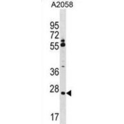 Canopy 3 Homolog (CNPY3) Antibody