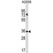 Acyl-CoA Binding Domain Containing 6 (ACBD6) Antibody