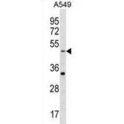 Gamma-Aminobutyric Acid Receptor Subunit Rho-2 (GABRR2) Antibody