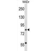 Protein Transport Protein Sec23B (SEC23B) Antibody