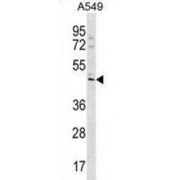 TBC1 Domain Family Member 20 (TBC1D20) Antibody