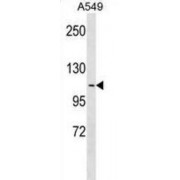 Apolipoprotein B-48 Receptor (APOB48R) Antibody